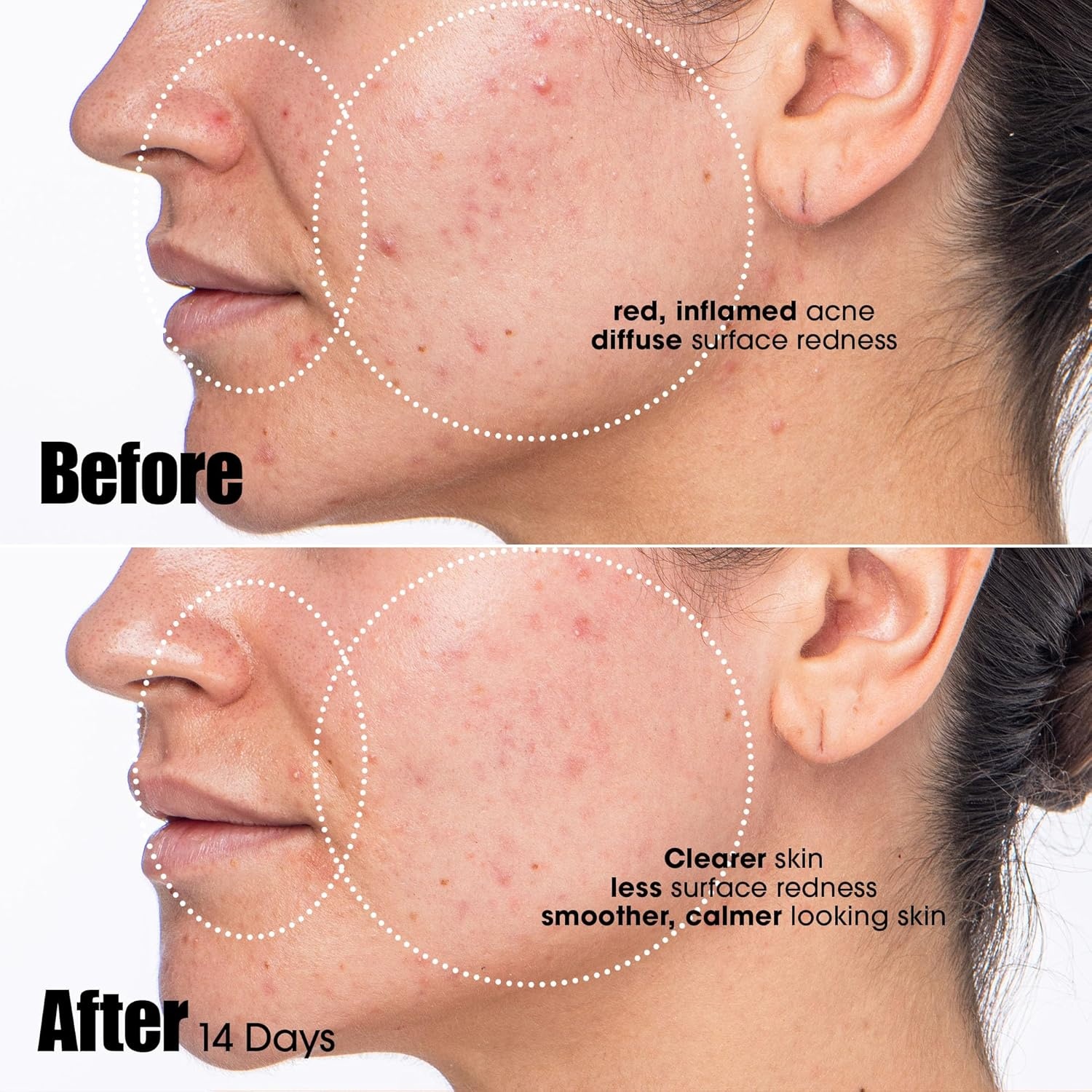 Sunday Riley Peacekeeper Azaleic and Salicylic Acid Acne Treatment Serum(Off White) - view 2